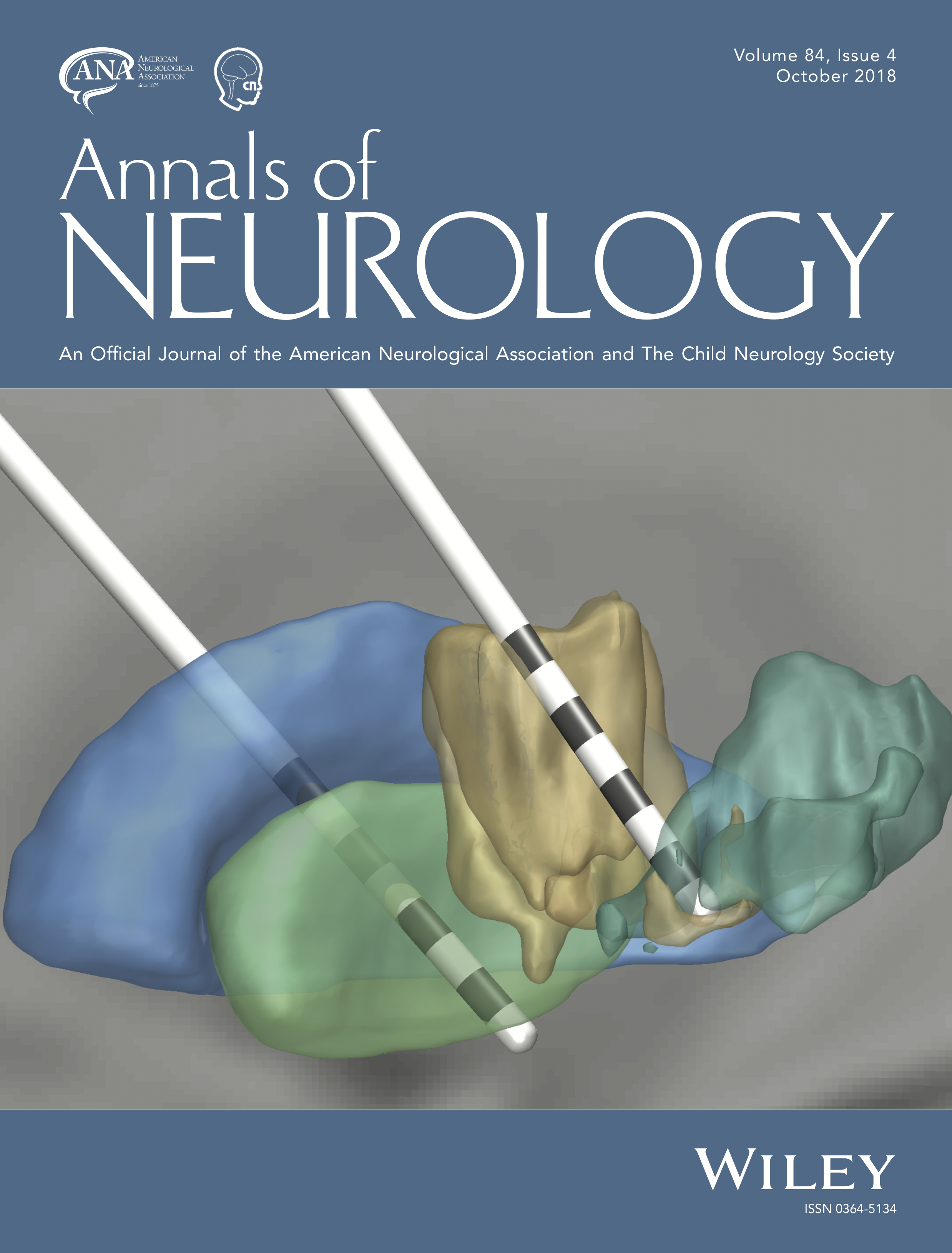 Crucial methodological updates for LeadDBS LeadDBS