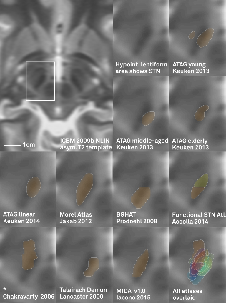 distal_fig_1