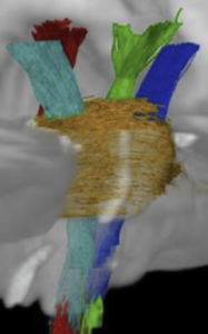 brainstem connectome atals