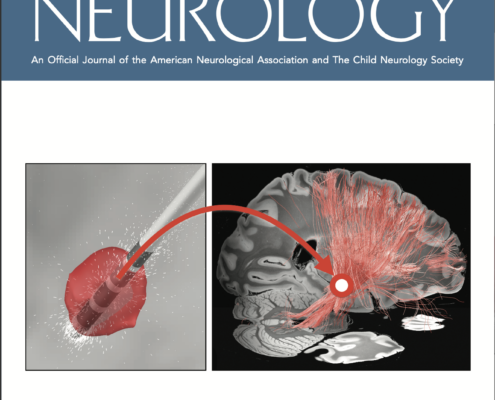 Annals of Neurology, 2022
