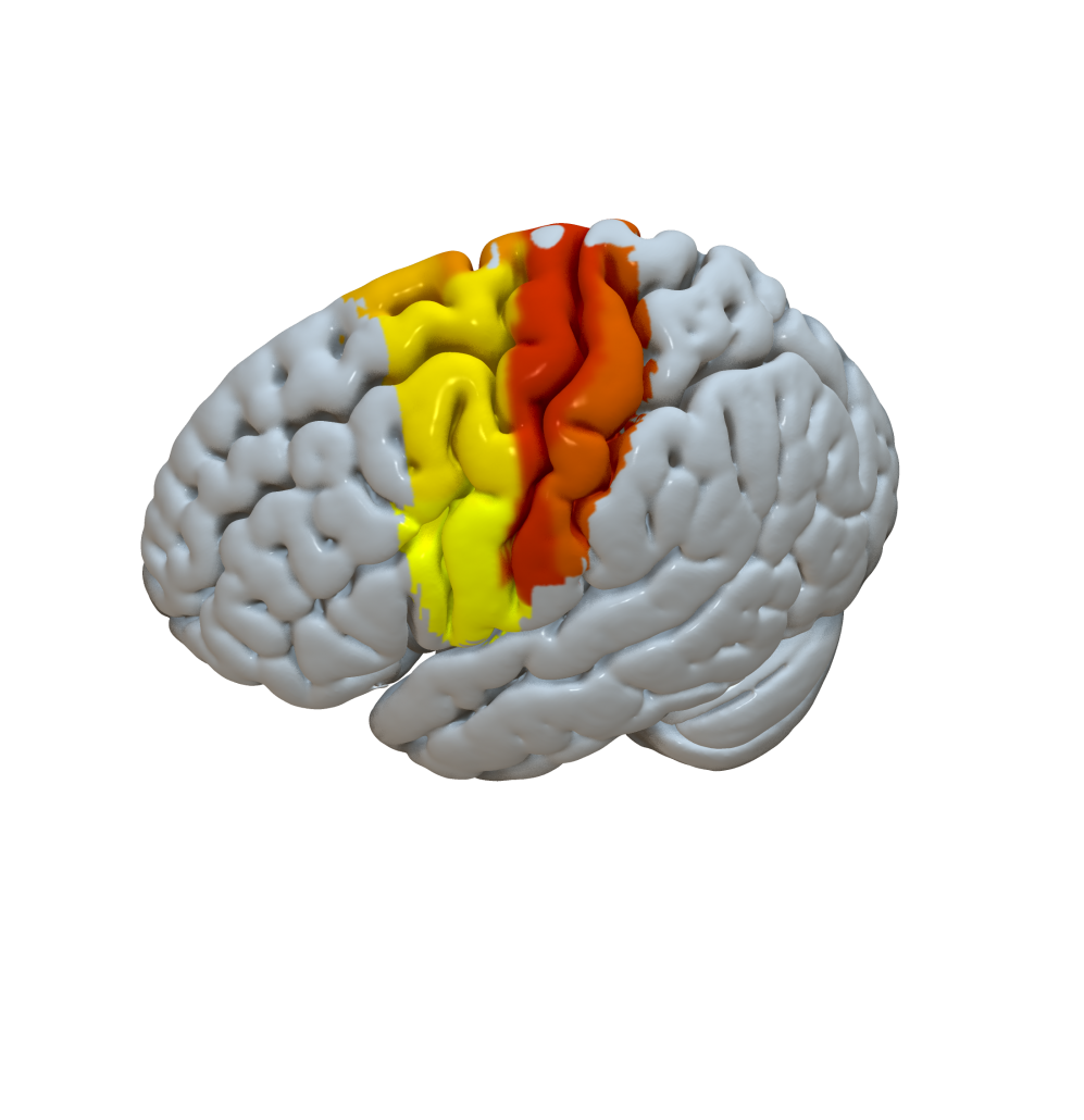 Cortical Atlas Parcellations Mni Space Lead Dbs